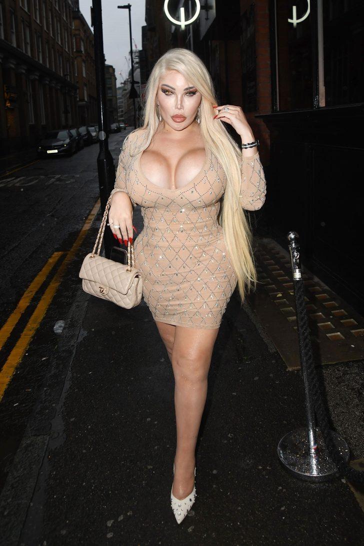 Türkiye'de tüp mide ameliyatı olan Jessica Alves elbisesiyle şaşkına çevirdi G2