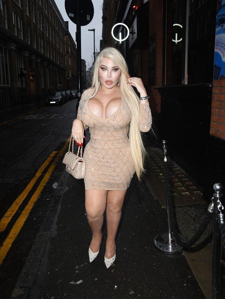 Türkiye'de tüp mide ameliyatı olan Jessica Alves elbisesiyle şaşkına çevirdi G3