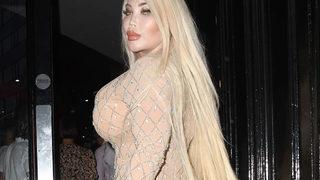 Türkiye'de tüp mide ameliyatı olan Jessica Alves elbisesiyle şaşkına çevirdi