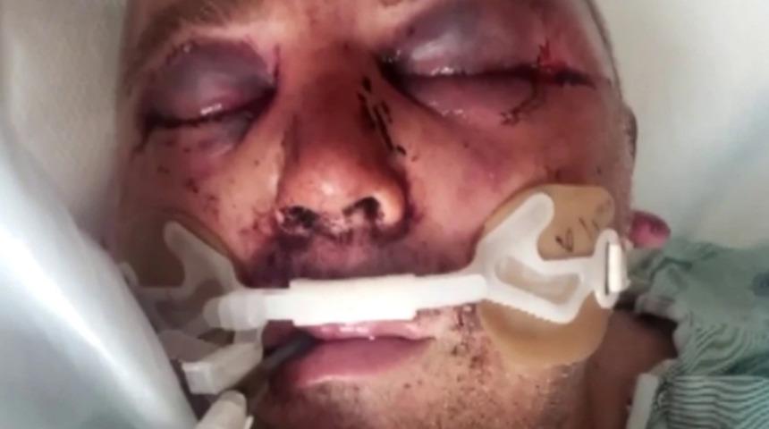 ABD'li adamı komalık ettiler! Müziğin sesinin kısılmasını istedi, tanınmaz hale geldi