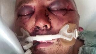 ABD'li adamı komalık ettiler! Müziğin sesinin kısılmasını istedi, tanınmaz hale geldi