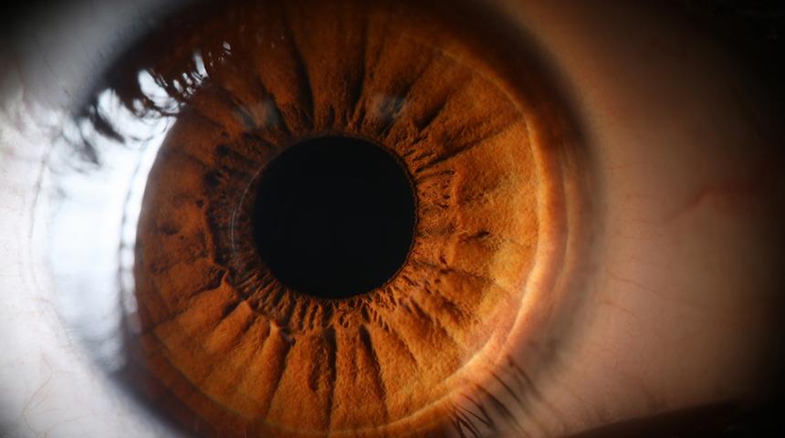 Retina yırtılması nasıl olur? İşte belirtileri ve tedavisi