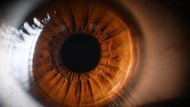 Retina yırtılması nasıl olur? İşte belirtileri ve tedavisi