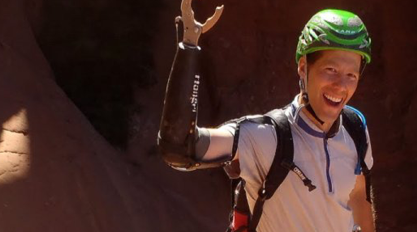 Ölümle yaşam arasında kaldı! Yaşamak için kendi kolunu kesen Aron Ralston’un hayatı filme konu oldu