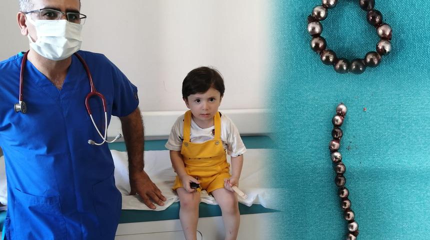 Mıknatıslı bilye yutan çocuğun bağırsakları delindi! 