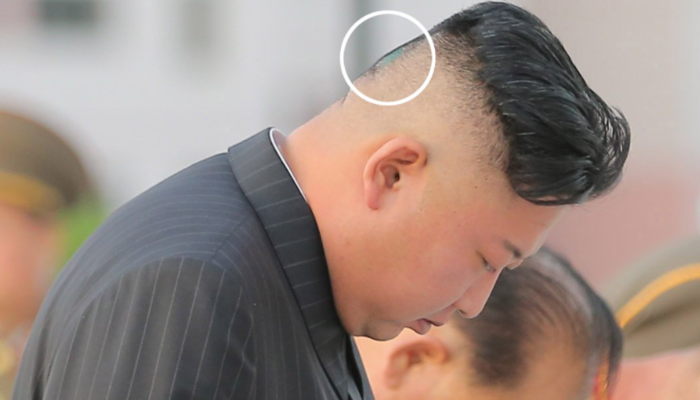 Kuzey Kore lideri Kim Jong-Un son görüntüsüyle konuşuluyor! Kafasının arkası çürüdü iddiası