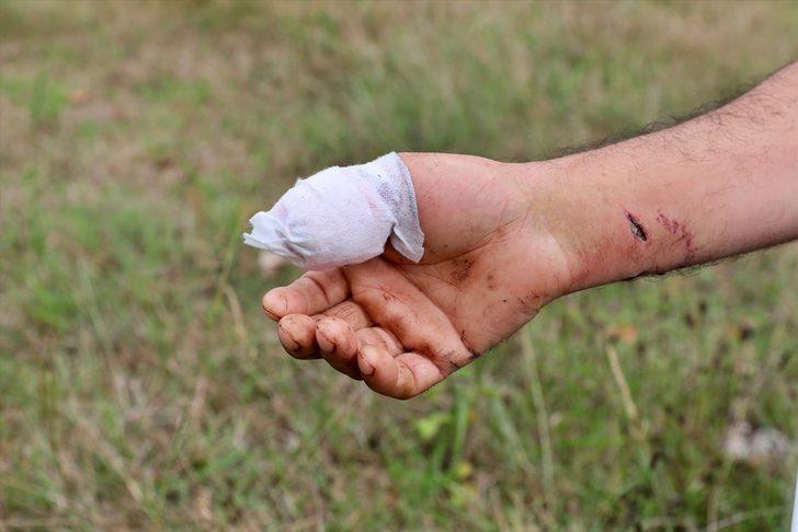 Samsun'da köpeğin saldırısına uğrayan kişi yaralandı G2