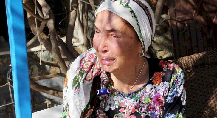 Başına gelmeyen kalmamıştı! İşte eski manken Bilun Dohmen'in son hali... G1