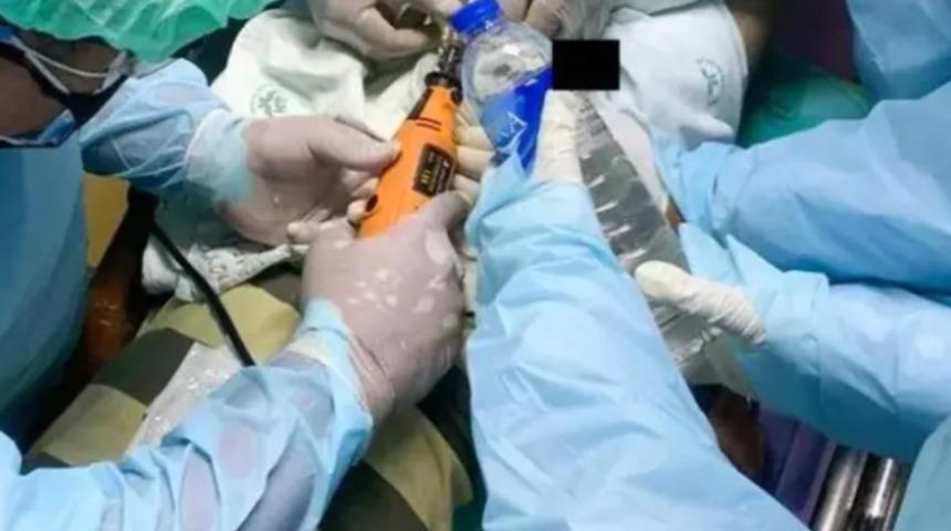 Akılalmaz olay! Daha fazla zevk almak istedi, penisinden oldu