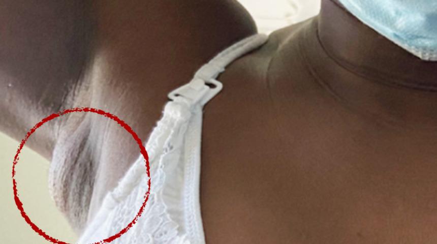 Şaşkına çeviren vaka! Koltuk altından süt akmaya başladı