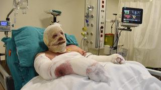 Denizli'deki yangında alevlerin arasında kaldı! Ormancı Yaşar, dehşet anlarını tek tek anlattı