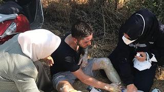 Yangından vücudu yanan gence ilk müdahaleyi AK Partili milletvekili yaptı