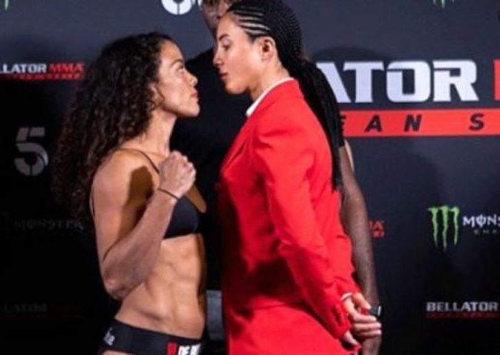 Survivor Sabriye Şengül bambaşka biri oldu! Estetik furyasına o da katıldı!  G4