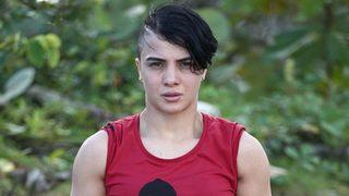 Survivor Sabriye Şengül bambaşka biri oldu! Estetik furyasına o da katıldı! 