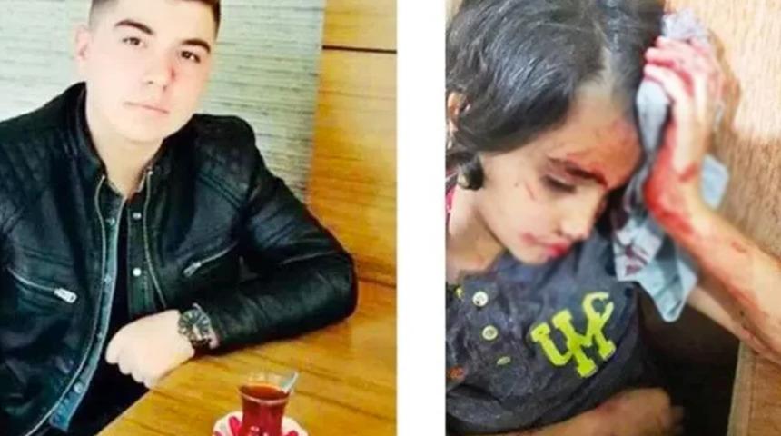 Altındağ'daki olaylar! Taşlarla yaralanan 6 yaşındaki Suriyeli İbrahim gündem oldu