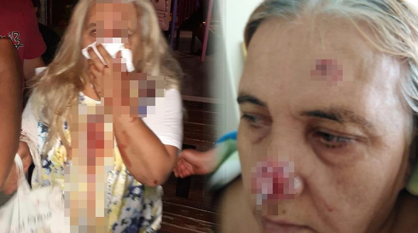 Çocuk parkında dehşeti yaşadı! "Geldiğimde burnu parçalanmış, sallanıyordu"