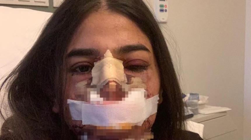 Genç kadına evlilik öncesi estetik şoku! Ameliyat sonrası neye uğradığını şaşırdı