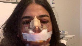 Genç kadına evlilik öncesi estetik şoku! Ameliyat sonrası neye uğradığını şaşırdı