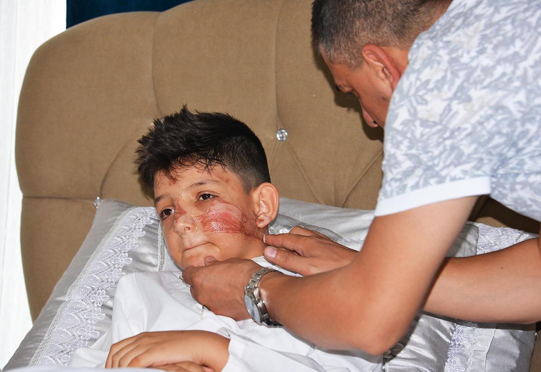 Bahşiş almak isterken s&uuml;nnet &ccedil;ocuğunu &ouml;ld&uuml;r&uuml;yorlardı!