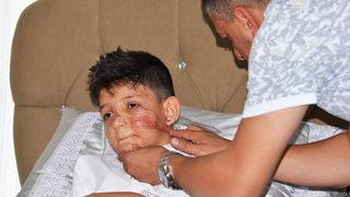 Bahşiş almak isterken sünnet çocuğunu öldürüyorlardı!