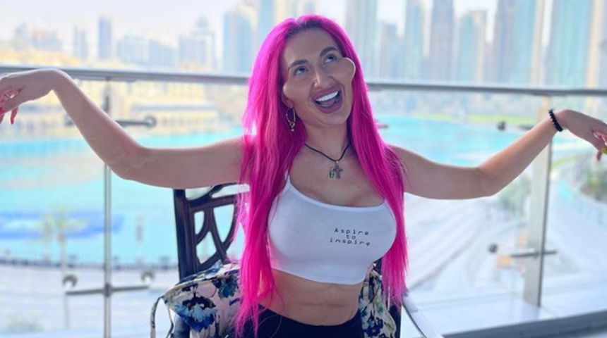 Dünyanın en büyük elmacık kemikli yanaklarına sahip olan Ukraynalı modeli Anastasia Pokreshchuk estetiksiz halini paylaştı