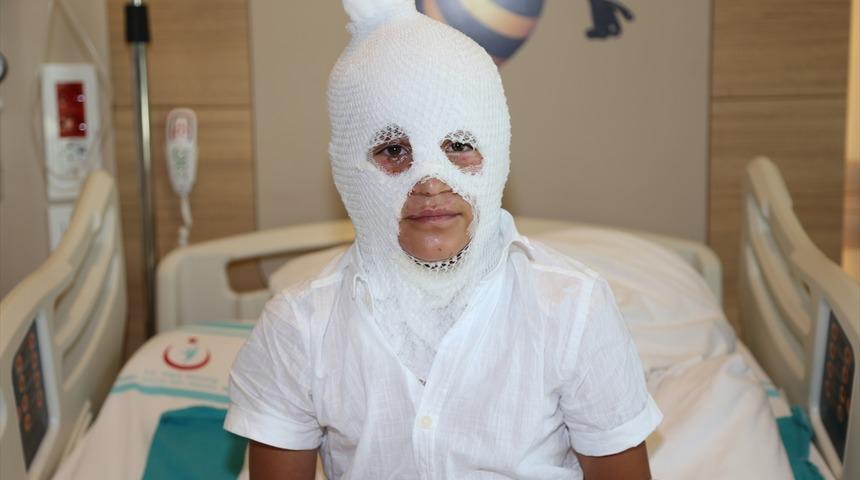 Arkadaşının yaktığı kolonyayı söndürürken yanan çocuk Erzurum'da tedaviye alındı