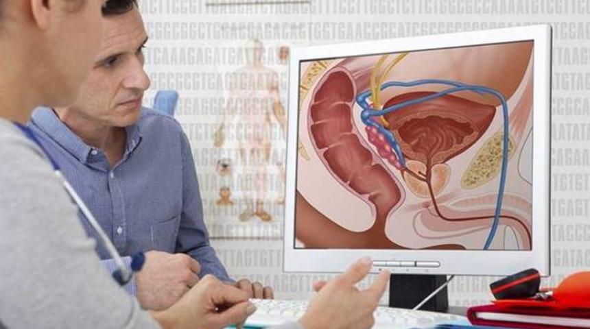 10 erkekten biri prostat kanseri