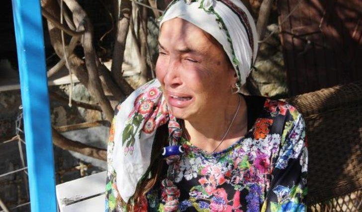 Bilun Dohmen şimdilerde ne yapıyor? Her şeyini bırakıp köye taşınmıştı: Çiftliğine hırsız girince... G5