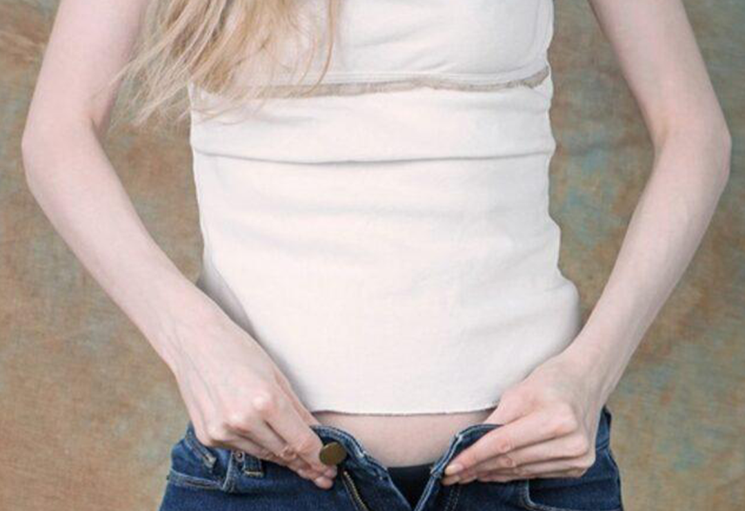 Hepsi birbirinden şık! G&uuml;zellik uğruna sağlığınızı tehdit eden 7 moda trendi