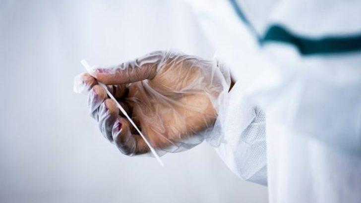 PCR testi nedir, fiyatı ne kadar? PCR testi nasıl yapılır, nerede yapılır? G5