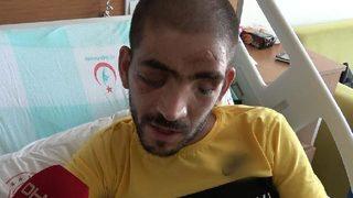 Geçirdiği kaza hayatını kararttı! 800 bin TL istediler