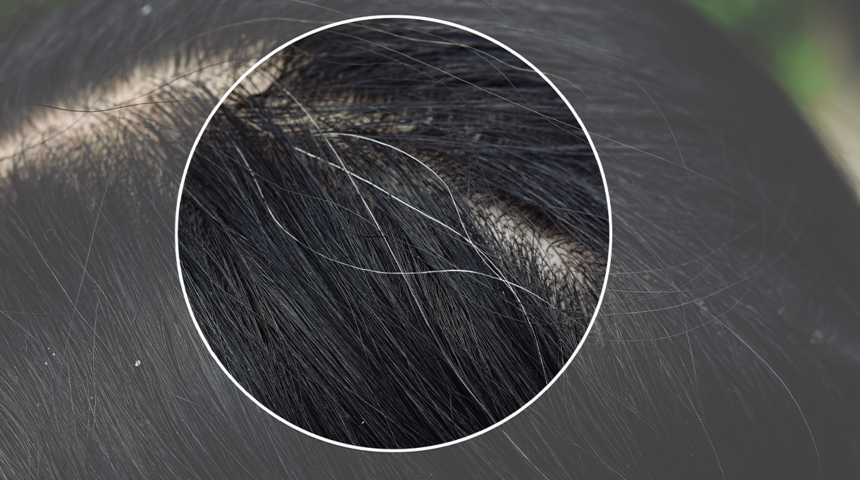 Beyaz saçlar sorun olmaktan çıktı! Saç beyazlamasına doğal çözüm önerileri