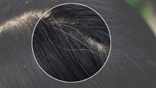 Beyaz saçlar sorun olmaktan çıktı! Saç beyazlamasına doğal çözüm önerileri