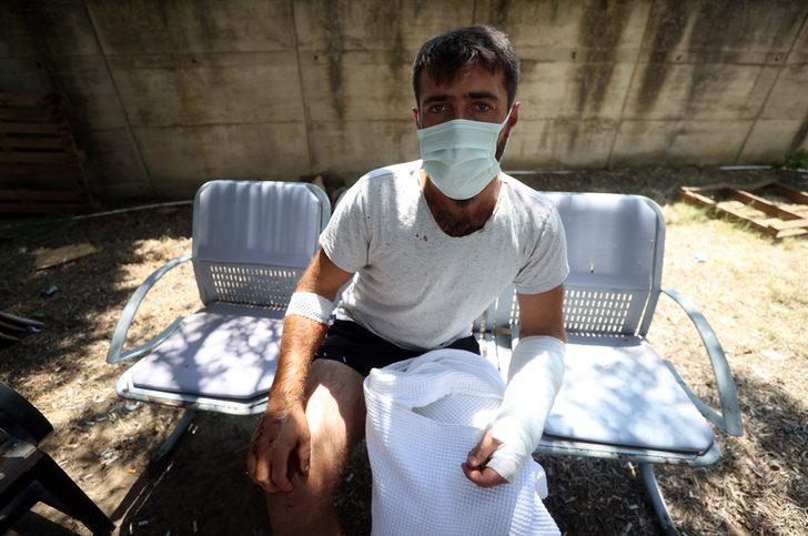 Kazdağları'nda yangın söndürme çalışmasına yardım ederken ayının saldırdığı Özkan Kaya, olayı anlattı: G3