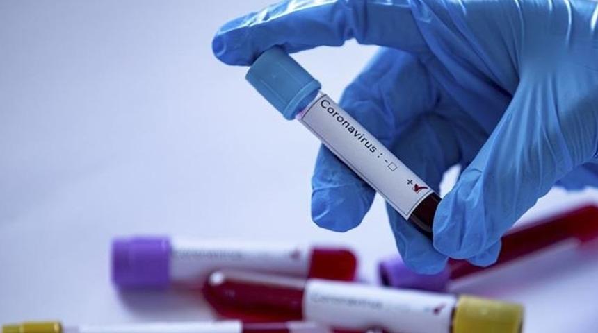 ABD'de korkutan rapor! Çocuk vakaların sayısı bir ayda 4 kattan fazla arttı