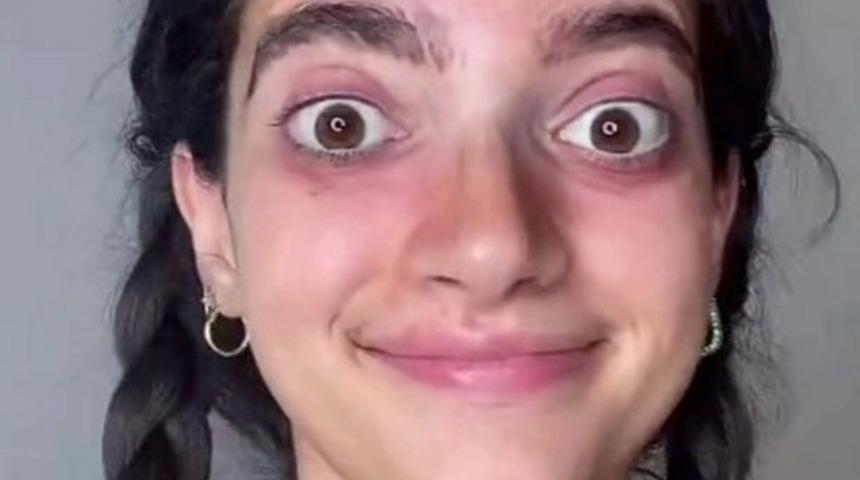 TikTok fenomeni Mr. Bean karakterine benzediğini söyleyenlere değişimiyle cevap verdi