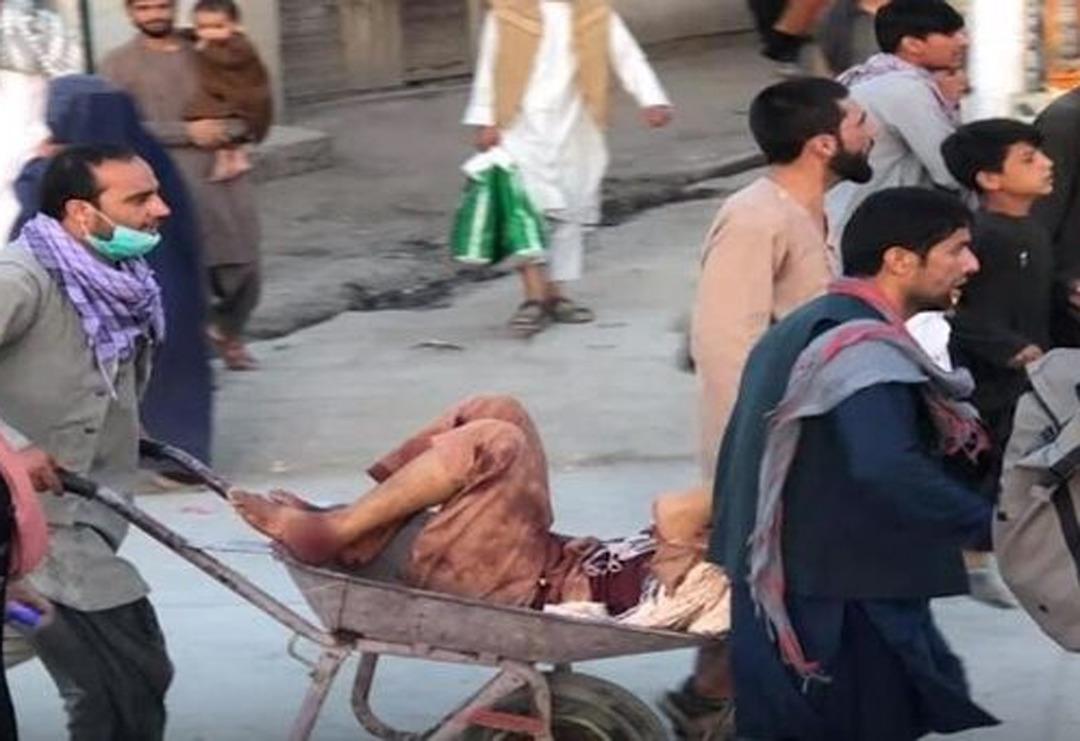 Son Dakika: Kabil'deki ter&ouml;r saldırılarında &ouml;l&uuml; ve yaralı sayısı y&uuml;kseldi