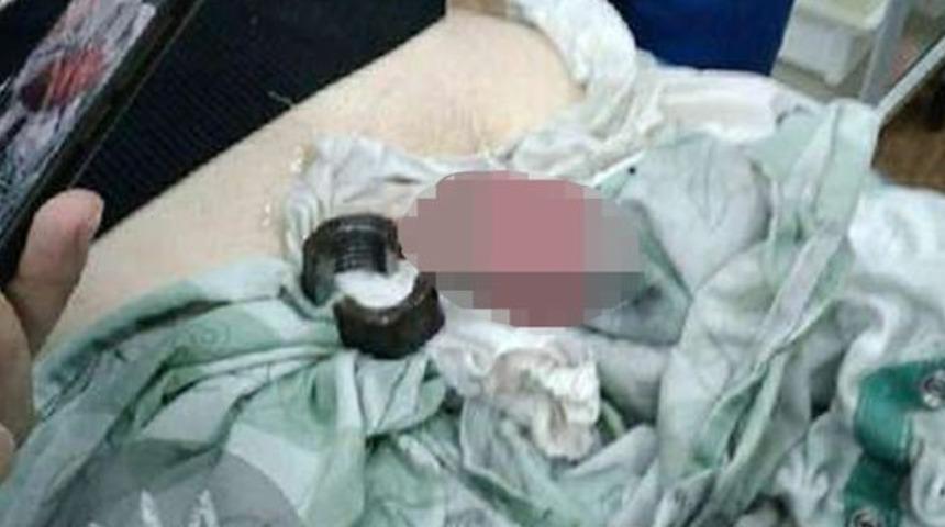 Ukraynalı kadının 'pes' dedirten intikamı! Kocasının penisine vida somunu geçirdi