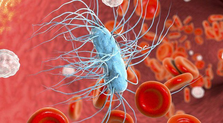 Sepsis nedir ve kimlerde görülür? Sepsis hastalığı tedavisi nedir? G2