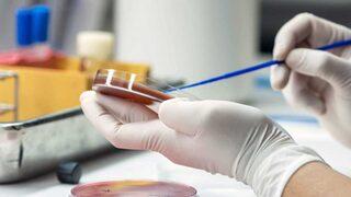 Sepsis nedir ve kimlerde görülür? Sepsis hastalığı tedavisi nedir?