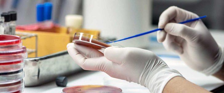 Sepsis nedir ve kimlerde görülür? Sepsis hastalığı tedavisi nedir? G5