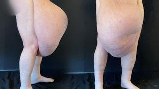 İnanılmaz görüntü! Bedeninden tam 35 kiloluk kitle çıktı