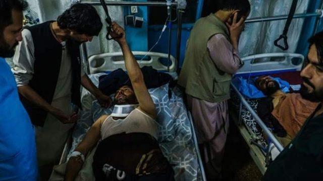 26 Ağustos'ta Kabil Havalimanı'na düzenlenen ve IŞİD'in Afganistan kolunun üstlendiği saldırılarda yaralananlardan biri