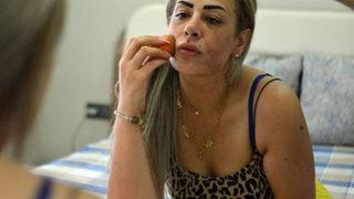 Güzellik merkezinde yaptırdığı peeling yüzünü yaktı! Genç kadın kabusu yaşadı