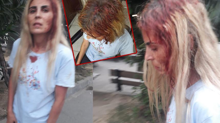 Eşinden gördüğü şiddet sonrası "Öldürülmek istemiyorum" demişti! Dehşeti yaşadı