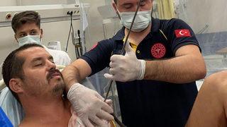 Tüyler ürperten olay! Göğsüne saplanan zıpkın, hastanede çıkarıldı