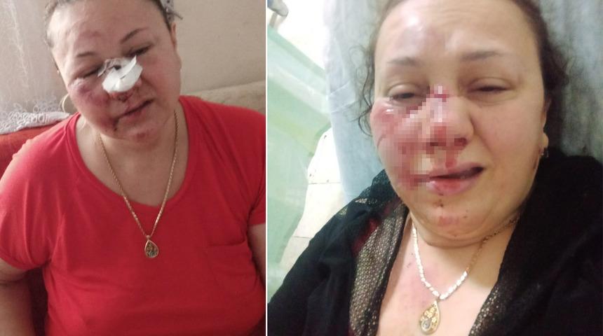 3 çocuk annesi dehşeti yaşadı! Eski erkek arkadaşı tarafından dövülüp arabadan atıldı