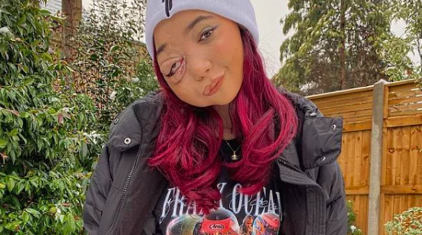 Hastalığı nedeniyle eleştirilen sosyal medya fenomeni Nikki Lilly, güzellik kalıplarına meydan okuyor