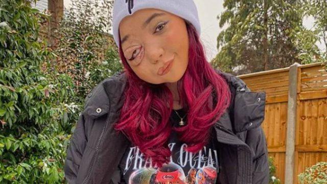 Hastalığı nedeniyle eleştirilen sosyal medya fenomeni Nikki Lilly, güzellik kalıplarına meydan okuyor