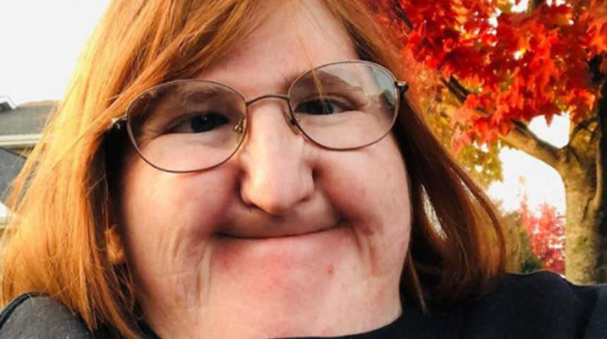 Melissa Blake, kendisini eleştirenlere New York Moda Haftası’nda modellik yaparak cevap verdi